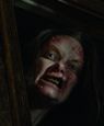 Traumatika